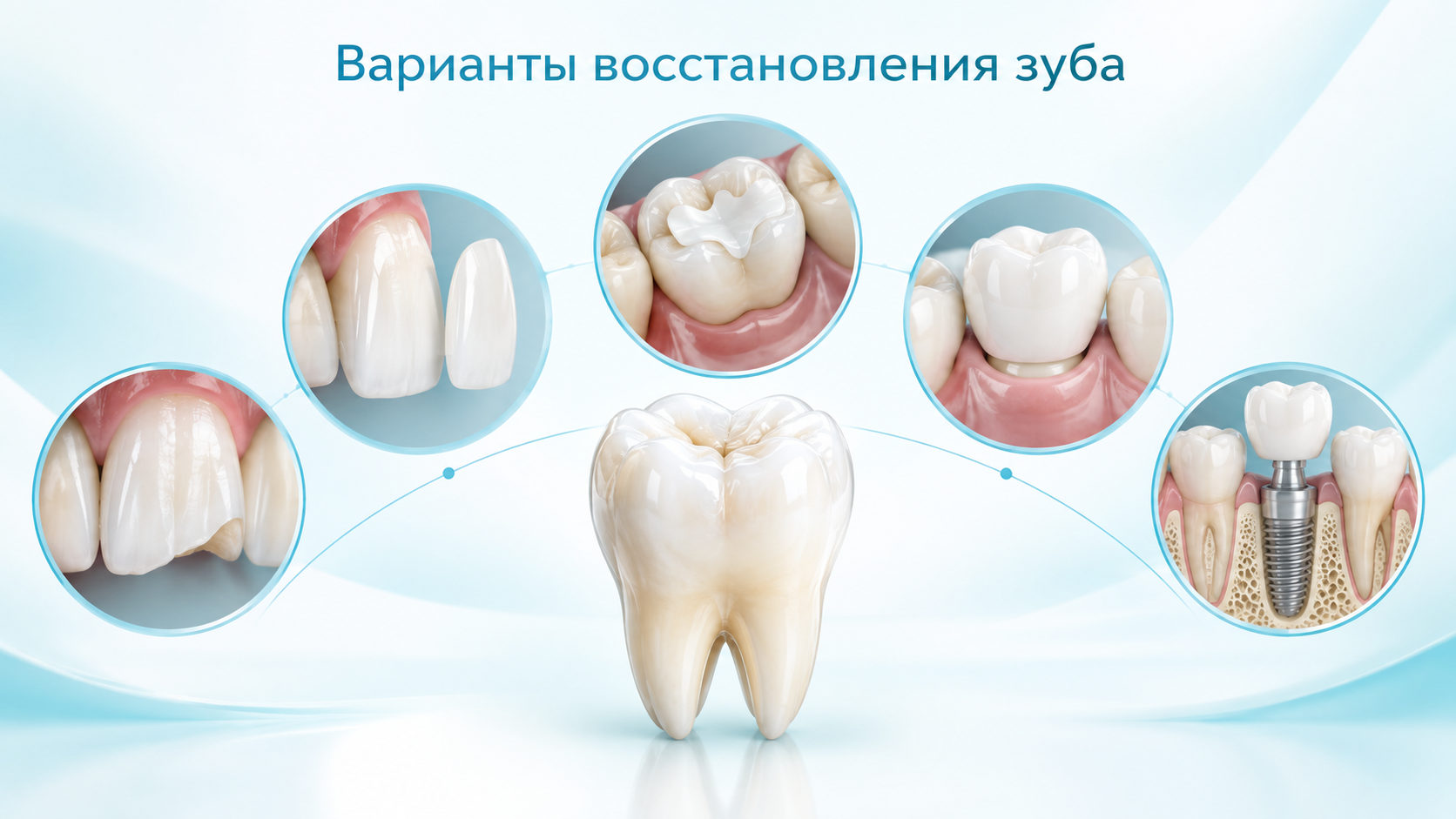 методы восстановления зубов в цифровой стоматологии
